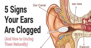 Signs Of Clogged Ears And How To Unclog Them