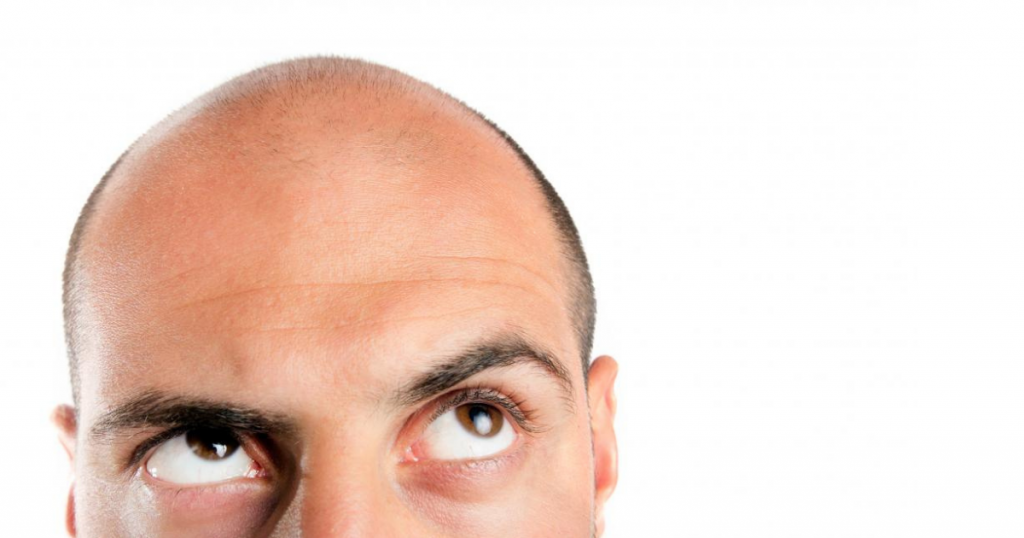 Worst Hairstyles For Balding Men