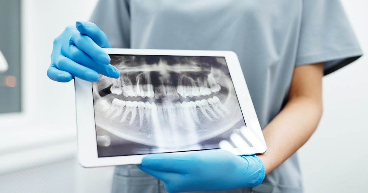 Replace Missing Teeth